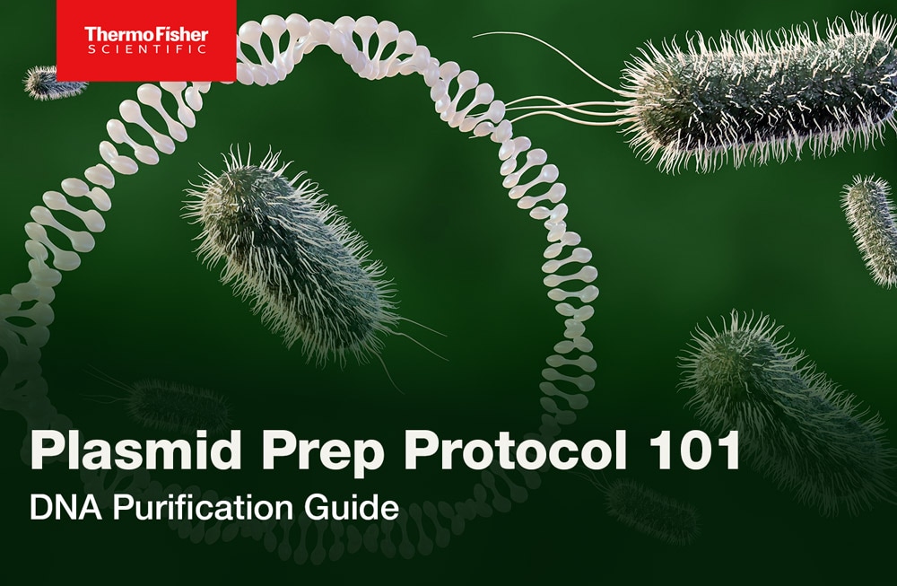 Plasmid prep protocol
