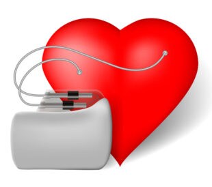 heart pacemaker