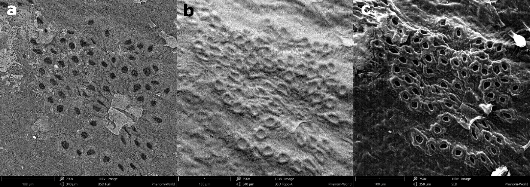 Leaf backscattered electron and secondary electron images