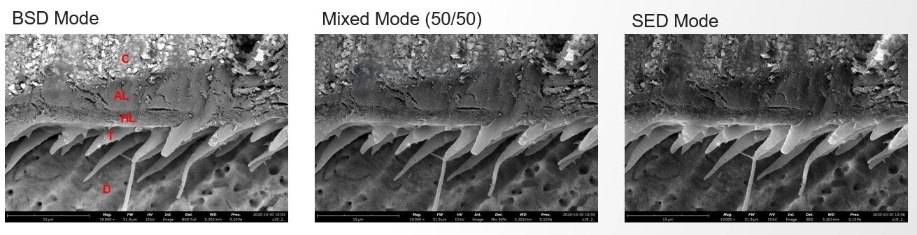 Secondary and backscattered electron images of composite fillings in human teeth