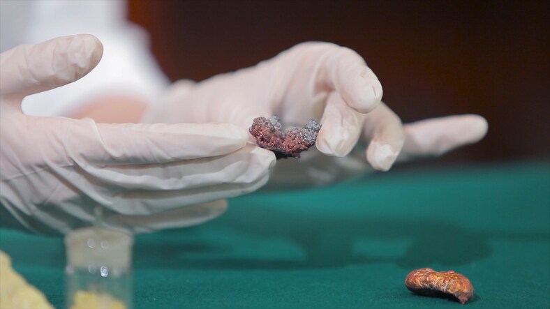 How Scientists Use XRD to Analyze Minerals
