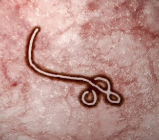 ebola virus under microscope
