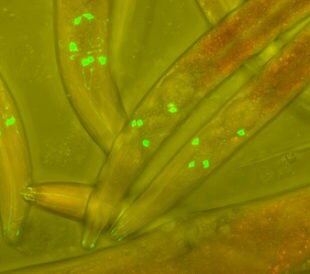 C. elegans. Image: Heiti Paves/Shutterstock.com