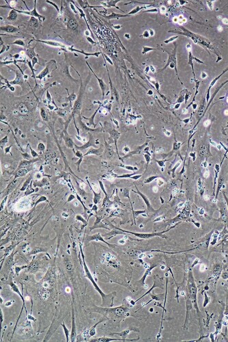 Muscle cells. Image: Paul Hakimata Photography/Shutterstock.com