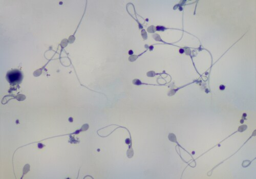 Sperm under a microscope. Image: Carolina K. Smith MD/Shutterstock.com