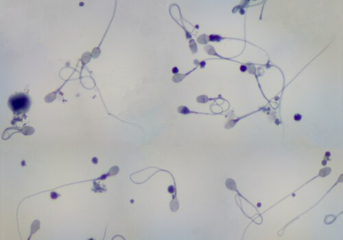 Normal sperm motility figures