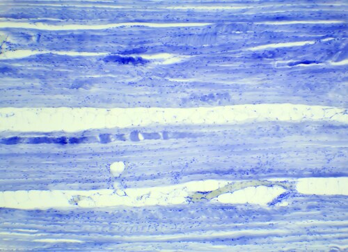Microscopic view of muscle fiber. Image: Aptyp_koK/Shutterstock.com