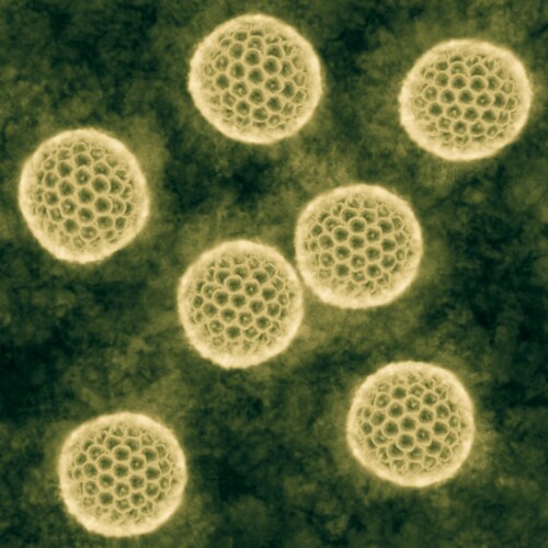 Microscopic view of Zika virus. Image: Nixx Photography/Shutterstock.com