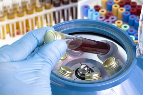 Hand putting a tube of blood into a centrifuge. Image: angellodeco/Shutterstock.com