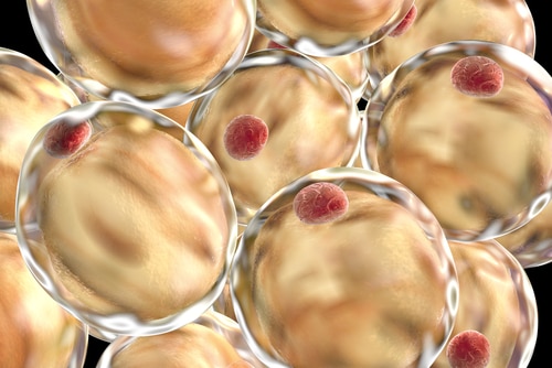 Fat cells. 3D illustration showing presence of big lipid droplet (yellow) inside the cell. The red structure is nucleus. Image: Kateryna Kon/Shutterstock.com.