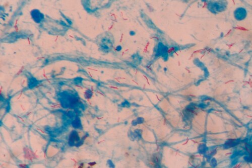 Mycobacterium tuberculosis gram-negative bacteria. Image: plenoy m/Shutterstock.com.