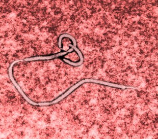 Ebola virus seen under a microscope with epidemic sign. Image: Studio_3321/Shutterstock.com.