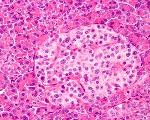 Profiling Human Islet Cells With Laser Capture Microdissection Profiling Human Islet Cells With Laser Capture Microdissection