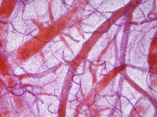 Blood vessels under microscope. Image: Anna Jurkovska/Shutterstock.com.