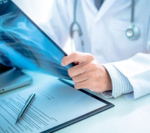 Close up of male doctor holding x-ray or roentgen image. Image: PORTRAIT IMAGES ASIA BY NONWARIT/Shutterstock.com.