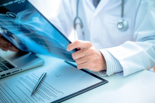 Close up of male doctor holding x-ray or roentgen image. Image: PORTRAIT IMAGES ASIA BY NONWARIT/Shutterstock.com.