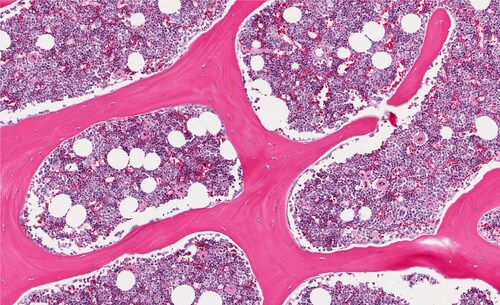 Normal healthy bone marrow depicting erythroid and myeloid cells. Image: vetpathologist/Shutterstock.com.