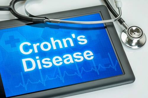 crohns disease