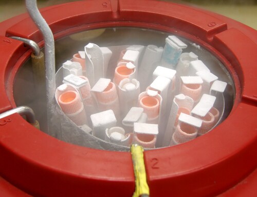 Cryogenic Preservation