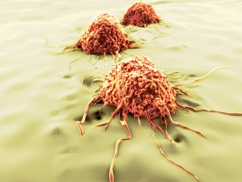 tumor cells metastasis