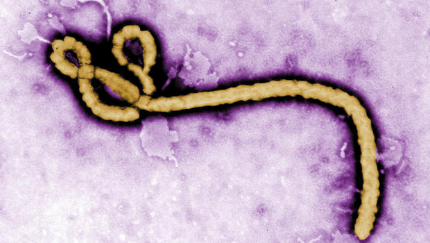Ebola