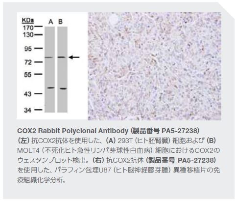 COX2 Rabbit Polyclonal Antibody