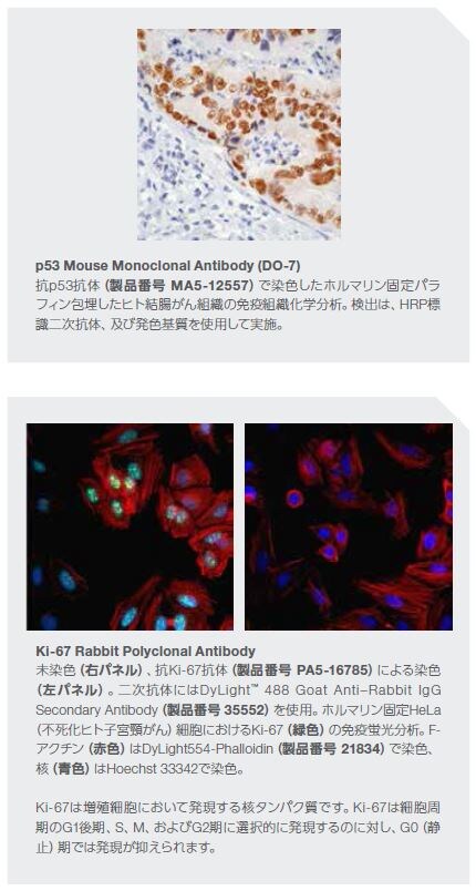p53 Mouse Monoclonal Antibody (DO-7)