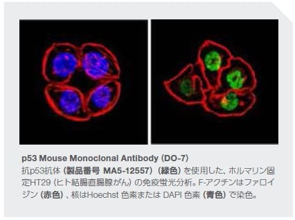 p53 Mouse Monoclonal Antibody（DO-7）