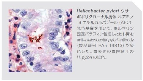 Helicobacter pylori ウサ ギポリクローナル抗体