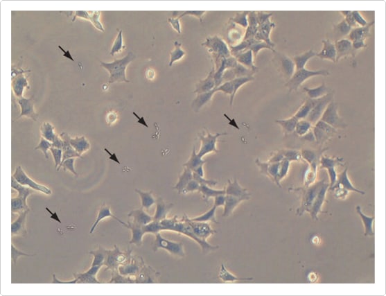 cell-culture-contamination-fig2
