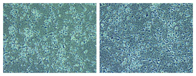 ヒトiPS細胞から神経細胞への分化誘導後４０⽇目　左： 従来の神経細胞⽤培地　右： Neurobasal Plus/B27 Plus