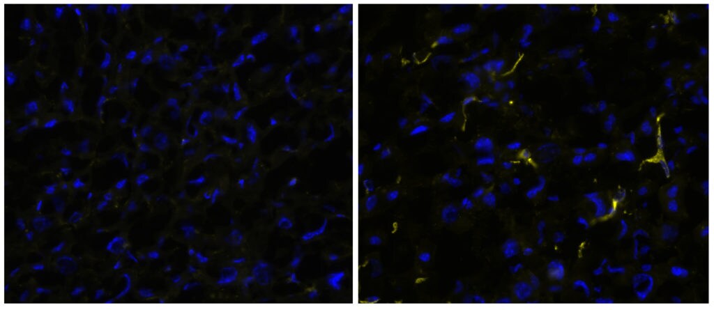 2 panel microscopic image of staining with anti-mouse CD163.