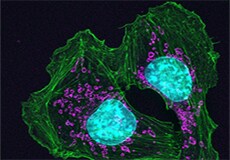 Mouse melanoma cells