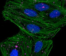 Qdot® Probes for in vivo