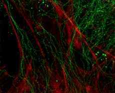 Antibody conjugates and labels for SIM