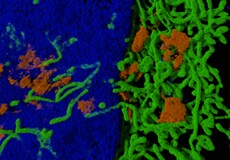DNA stains for SIM