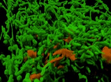 Live-cell labeling with fluorescent proteins for SIM