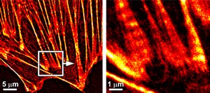 Organelle probes for STORM