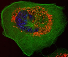 Oxidative Stress Detection