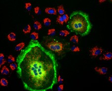 Investigating and correcting weak signals from GFP fusion proteins