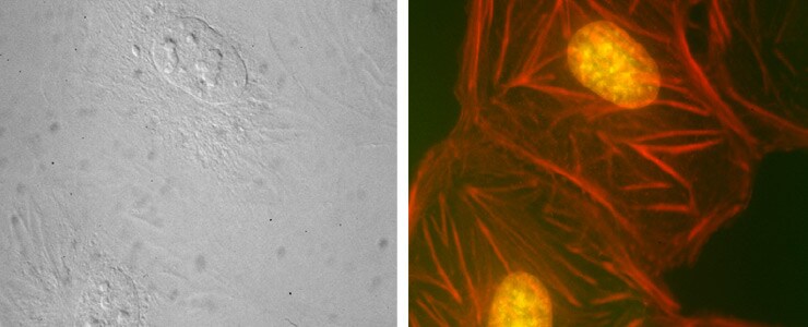 an image of the same field of stained BPAE cells captured using brightfield (left) and fluorescence (right) microscopy