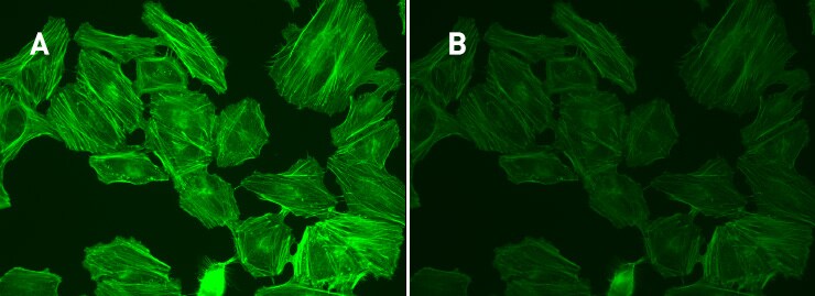 Side-by-side stained cell images showing an intensely fluorescent image (right panel) that dims over time with exposure to illumination from the microscope (right panel).