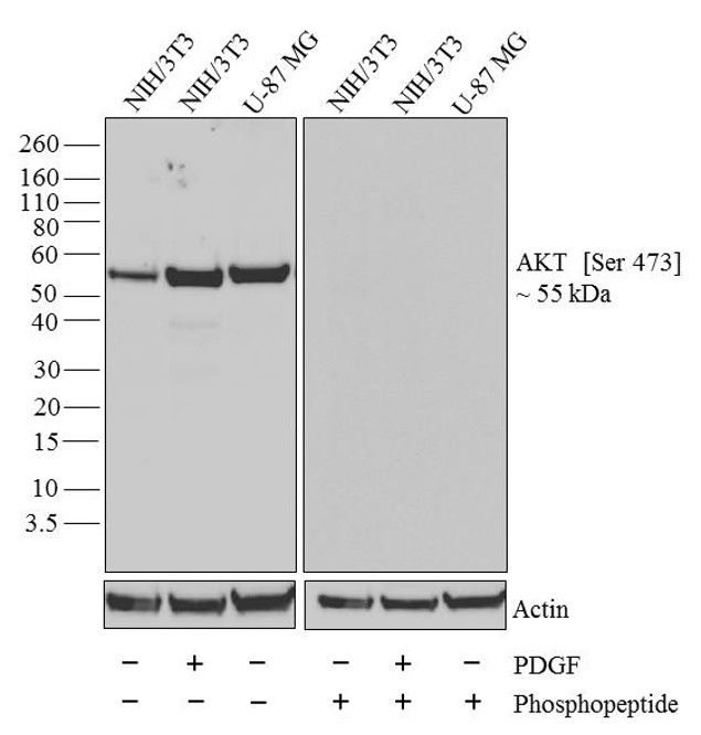 Western blot analysis of AKT [pS473]