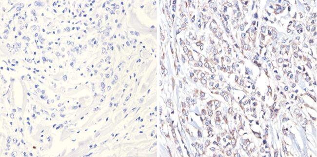 Immunohistochemistry