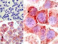 human HeLa cells