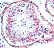 Immunohistochemical analysis