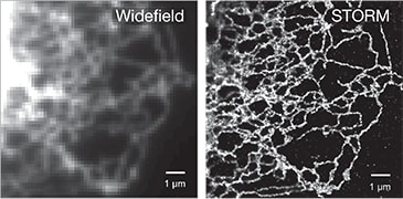 ER traditional microscopy and stochastic optical reconstruction microscopy 