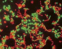 Image of bacteria stained with the LIVE/DEAD BacLight Bacterial Viability Kit