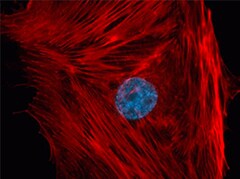 Multicolor staining of BPAE cells