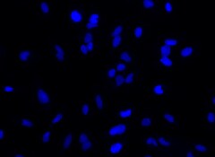 Cells stained with Hoechst® 33342